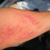 arminjury-wakeboarding-wakeskating-photos.jpg