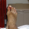 IMAGE: Marks Toe